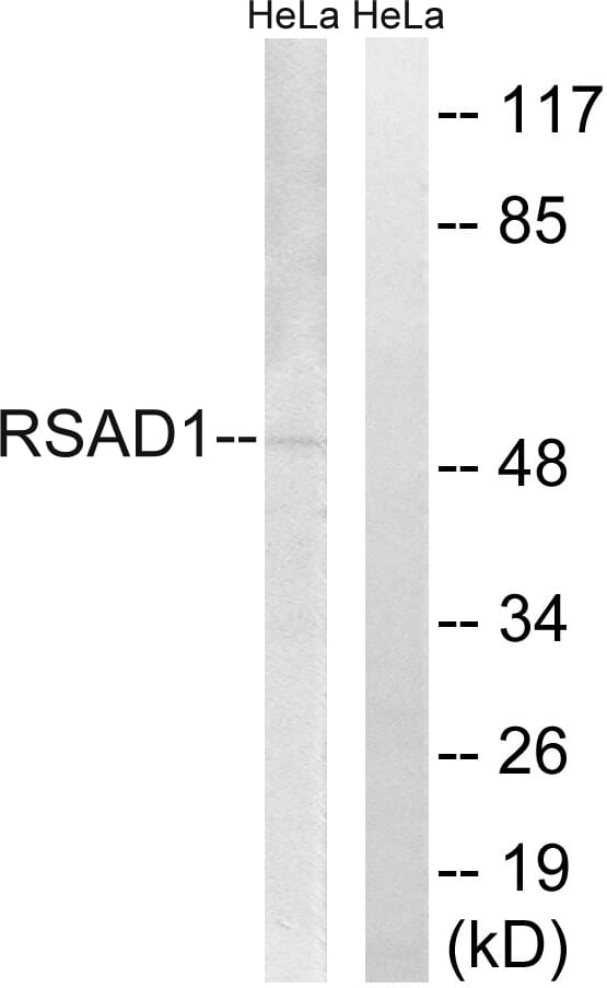 Western blot analysis of lysates from HeLa cells using Anti-RSAD1 Antibody. The right hand lane represents a negative control, where the antibody is blocked by the immunising peptide.