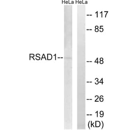 Western Blot - Anti-RSAD1 Antibody (C18142) - Antibodies.com