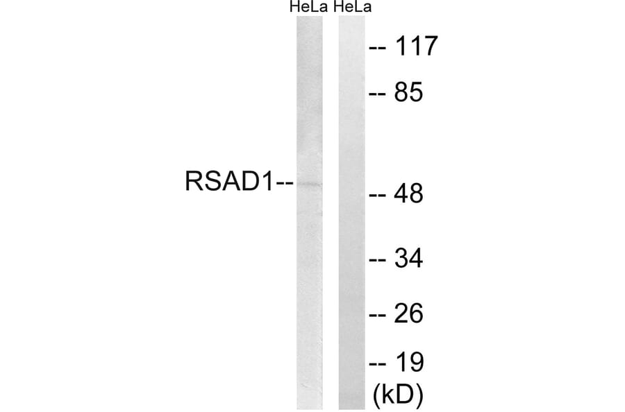 Western Blot - Anti-RSAD1 Antibody (C18142) - Antibodies.com