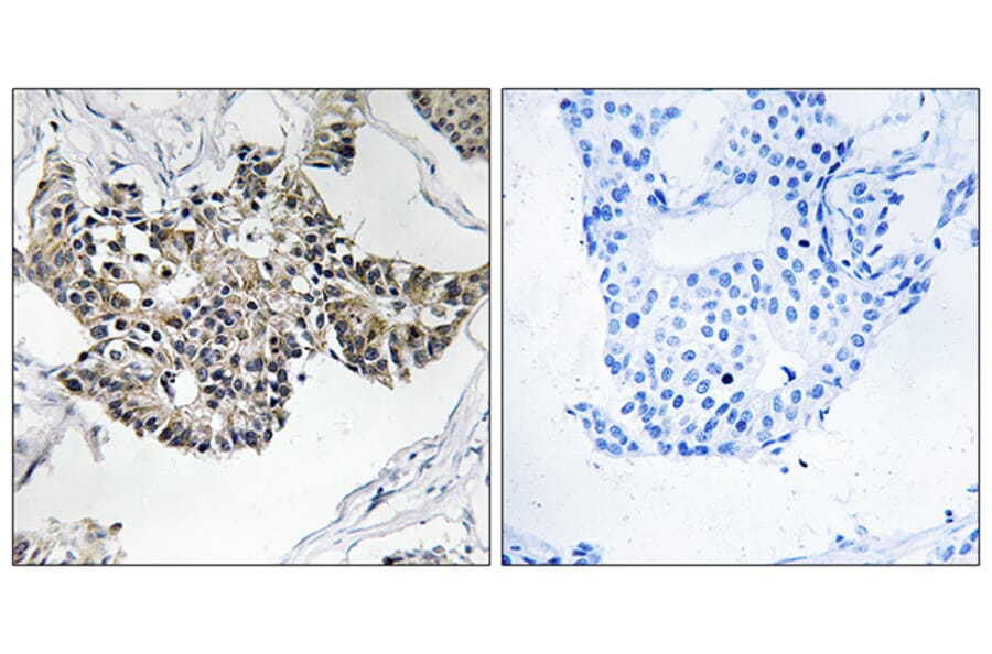 Immunohistochemistry - Anti-RSAD1 Antibody (C18142) - Antibodies.com