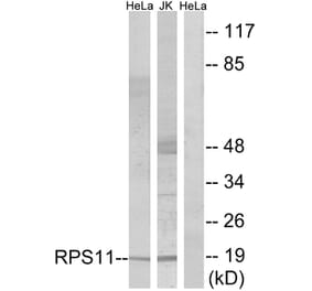 Western Blot - Anti-RPS11 Antibody (C14094) - Antibodies.com
