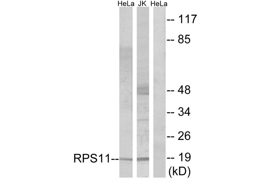 Western Blot - Anti-RPS11 Antibody (C14094) - Antibodies.com