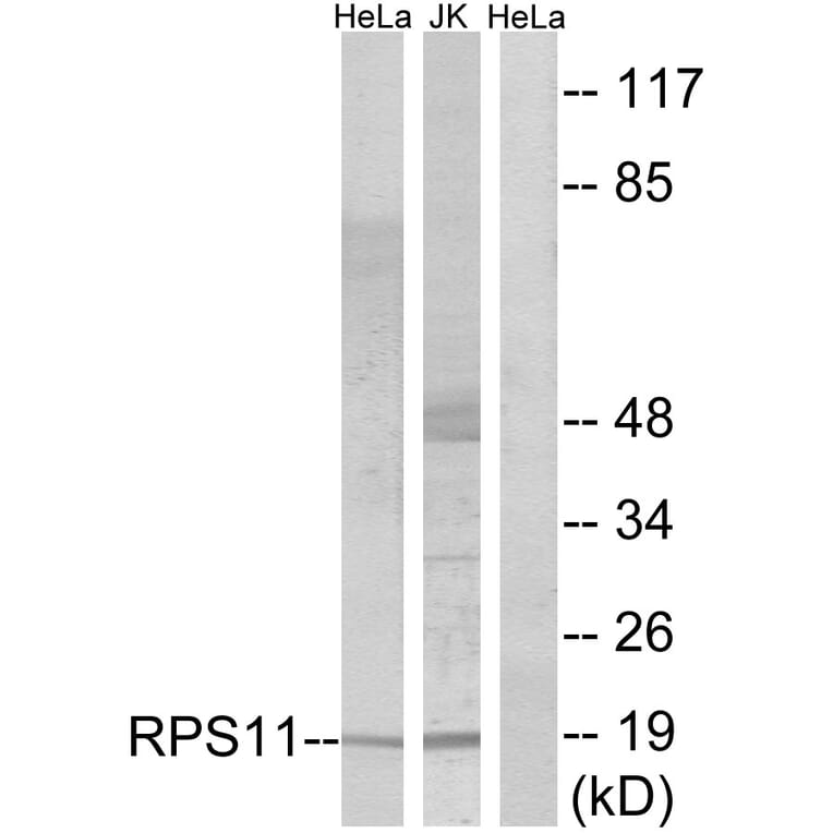 Western Blot - Anti-RPS11 Antibody (C14094) - Antibodies.com