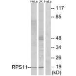 Western Blot - Anti-RPS11 Antibody (C14094) - Antibodies.com