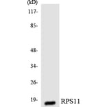 Western Blot - Anti-RPS11 Antibody (R12-3460) - Antibodies.com