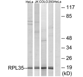Western Blot - Anti-RPL35 Antibody (C14173) - Antibodies.com