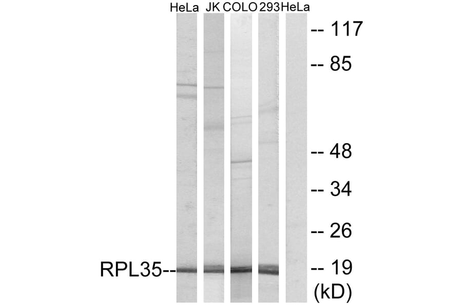 Western Blot - Anti-RPL35 Antibody (C14173) - Antibodies.com