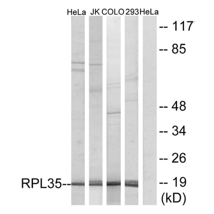 Western Blot - Anti-RPL35 Antibody (C14173) - Antibodies.com