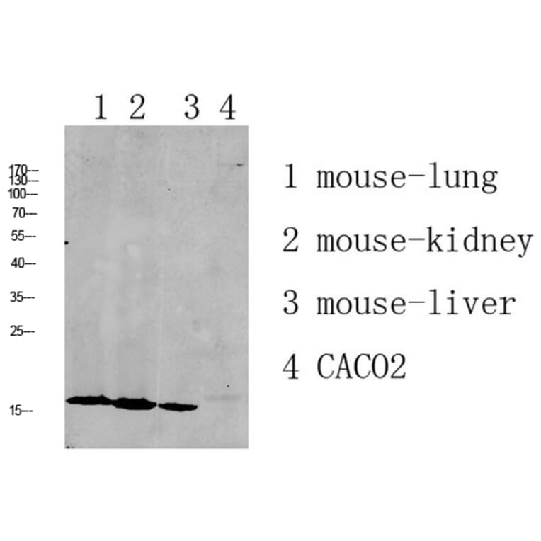 Western Blot - Anti-RPL35 Antibody (C14173) - Antibodies.com