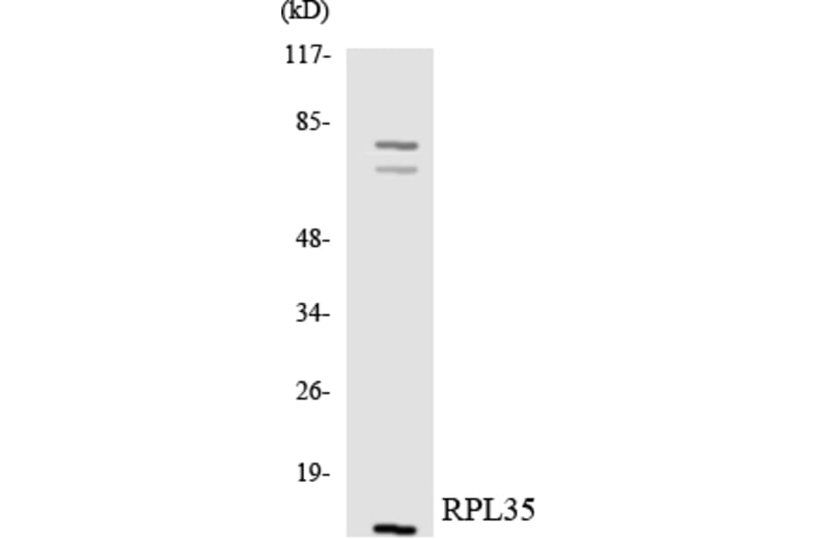Western Blot - Anti-RPL35 Antibody (R12-3457) - Antibodies.com