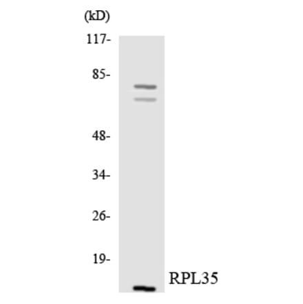 Western Blot - Anti-RPL35 Antibody (R12-3457) - Antibodies.com