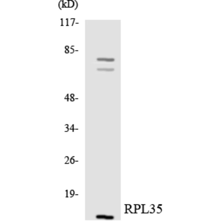 Western Blot - Anti-RPL35 Antibody (R12-3457) - Antibodies.com