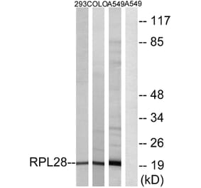 Western Blot - Anti-RPL28 Antibody (C14166) - Antibodies.com