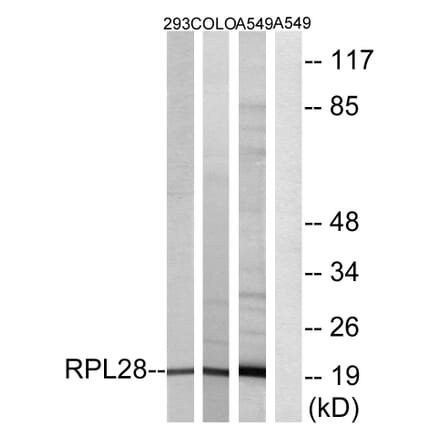 Western Blot - Anti-RPL28 Antibody (C14166) - Antibodies.com