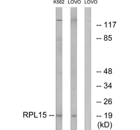 Western Blot - Anti-RPL15 Antibody (C14152) - Antibodies.com
