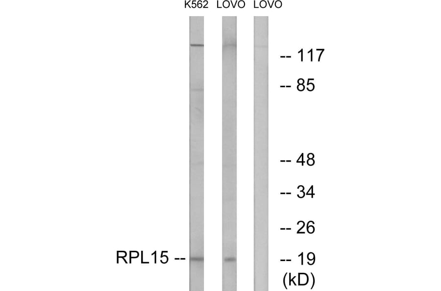 Western Blot - Anti-RPL15 Antibody (C14152) - Antibodies.com