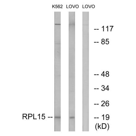 Western Blot - Anti-RPL15 Antibody (C14152) - Antibodies.com