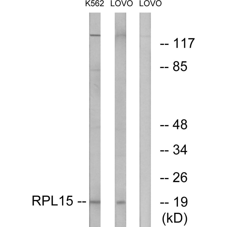 Western Blot - Anti-RPL15 Antibody (C14152) - Antibodies.com