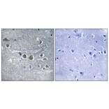 Immunohistochemistry - Anti-RPL15 Antibody (C14152) - Antibodies.com