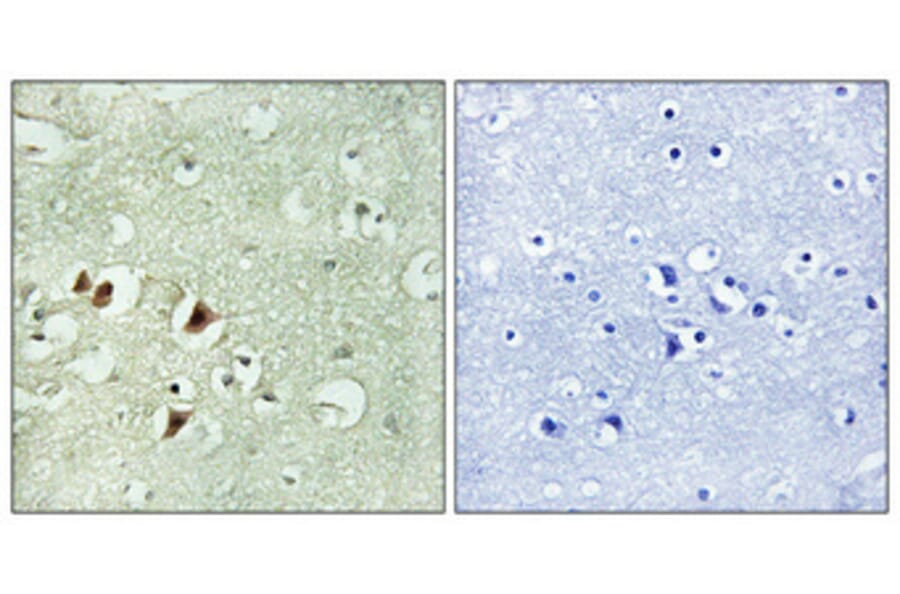 Immunohistochemistry - Anti-RPL15 Antibody (C14152) - Antibodies.com