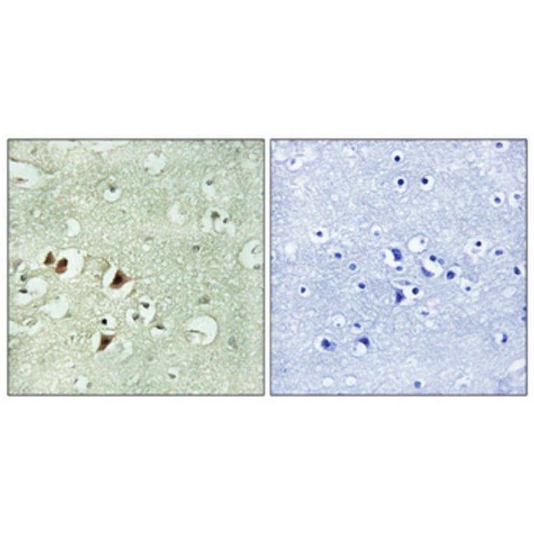 Immunohistochemistry - Anti-RPL15 Antibody (C14152) - Antibodies.com