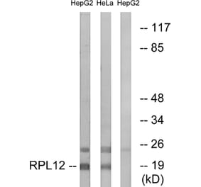 Western Blot - Anti-RPL12 Antibody (C14148) - Antibodies.com