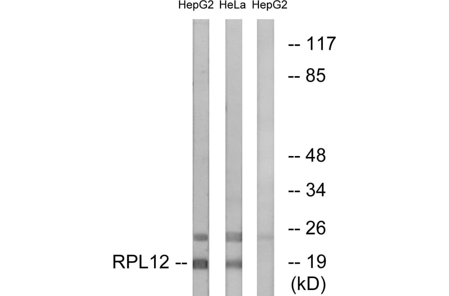 Western Blot - Anti-RPL12 Antibody (C14148) - Antibodies.com