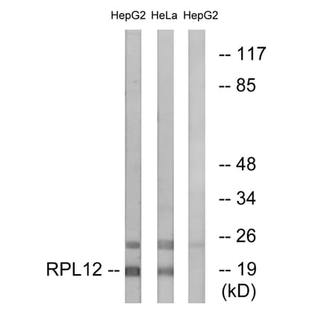 Western Blot - Anti-RPL12 Antibody (C14148) - Antibodies.com