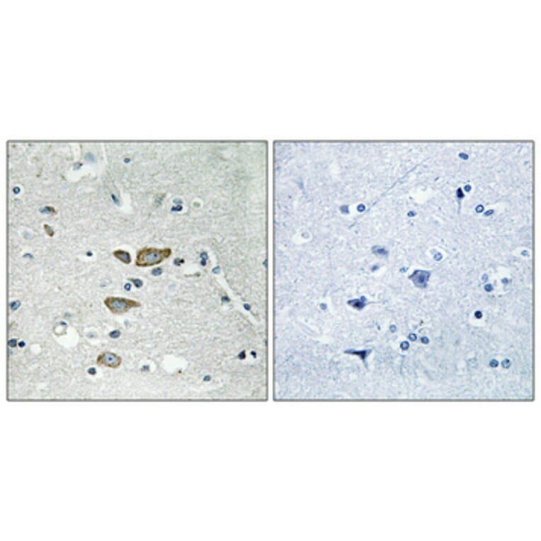 Immunohistochemistry - Anti-RPL12 Antibody (C14148) - Antibodies.com