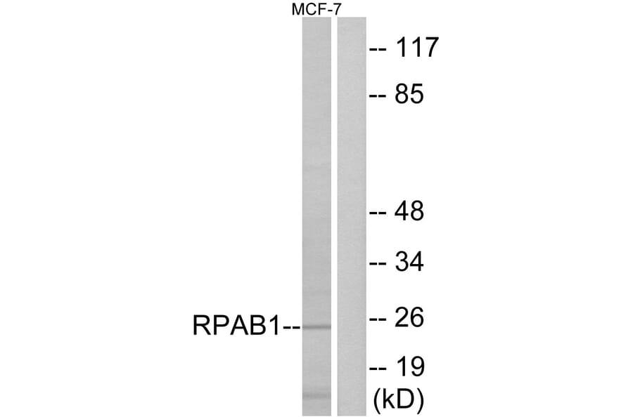 Western Blot - Anti-RPAB1 Antibody (C15486) - Antibodies.com