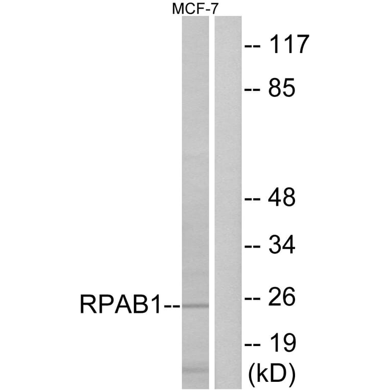 Western Blot - Anti-RPAB1 Antibody (C15486) - Antibodies.com