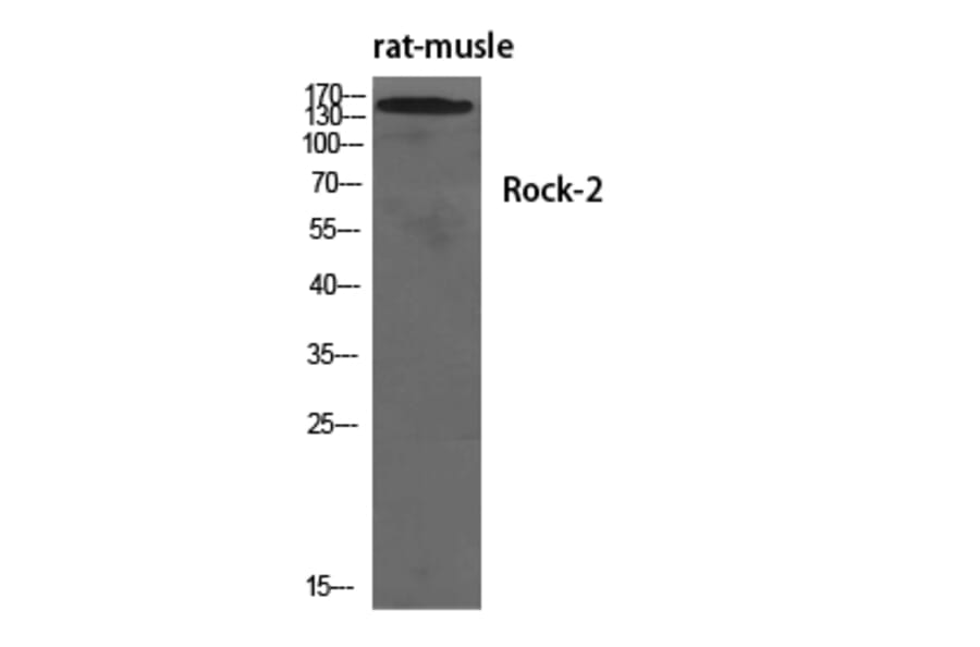 Western Blot - Anti-ROCK2 Antibody (B8541) - Antibodies.com
