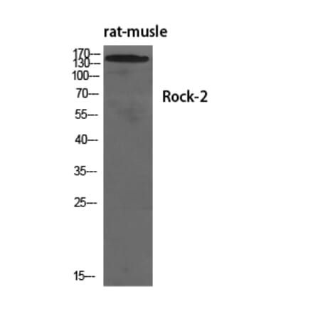 Western Blot - Anti-ROCK2 Antibody (B8541) - Antibodies.com