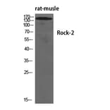 Western Blot - Anti-ROCK2 Antibody (B8541) - Antibodies.com