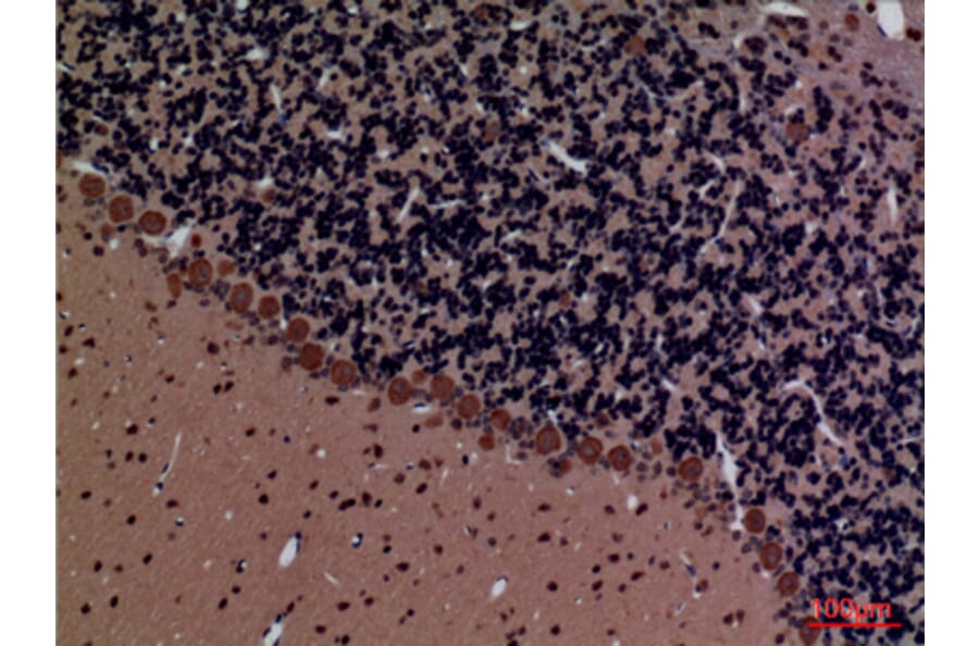 Immunohistochemistry - Anti-ROCK2 Antibody (C30123) - Antibodies.com