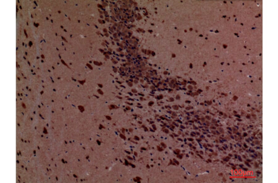 Immunohistochemistry - Anti-ROCK2 Antibody (C30123) - Antibodies.com