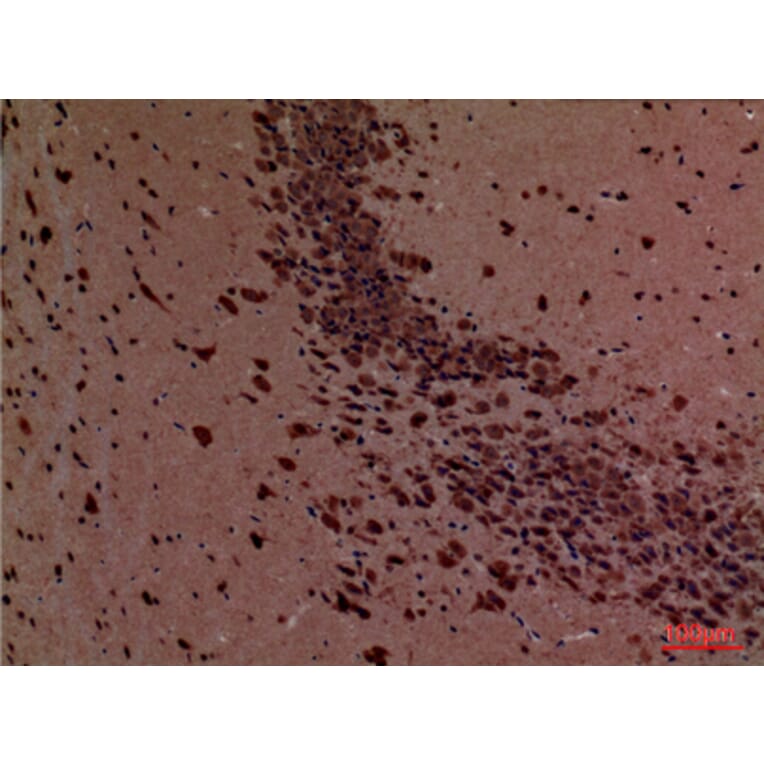 Immunohistochemistry - Anti-ROCK2 Antibody (C30123) - Antibodies.com