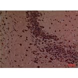 Immunohistochemistry - Anti-ROCK2 Antibody (C30123) - Antibodies.com