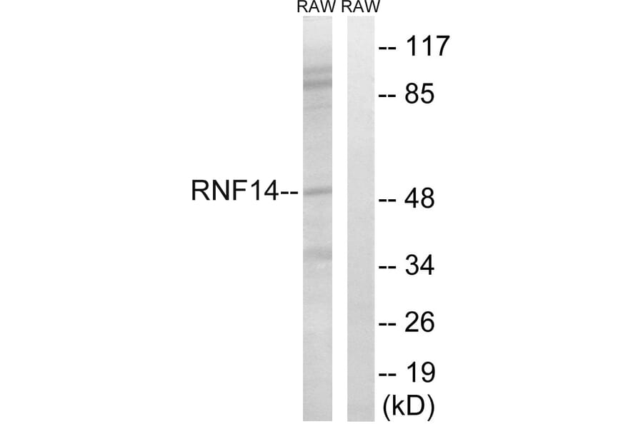 Western Blot - Anti-RNF14 Antibody (C15573) - Antibodies.com