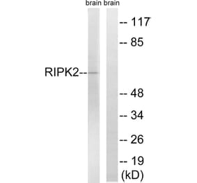 Western Blot - Anti-RIPK2 Antibody (B8180) - Antibodies.com