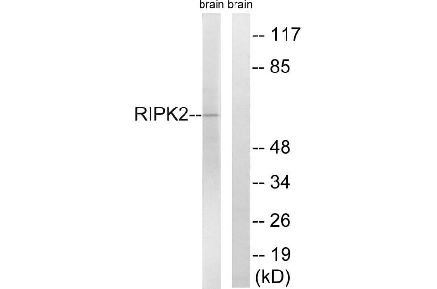 Western Blot - Anti-RIPK2 Antibody (B8180) - Antibodies.com