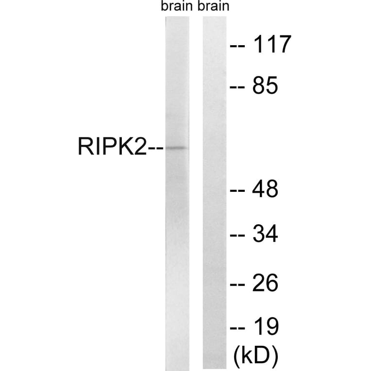 Western Blot - Anti-RIPK2 Antibody (B8180) - Antibodies.com