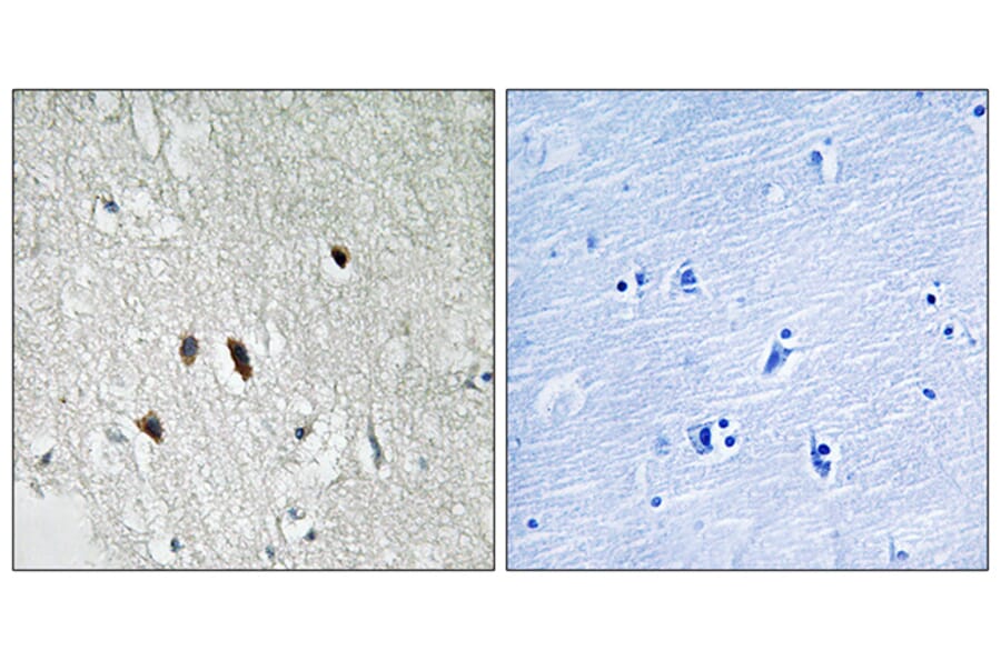 Immunohistochemistry - Anti-RIPK2 Antibody (B8180) - Antibodies.com