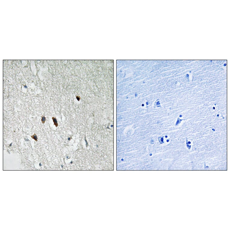 Immunohistochemistry - Anti-RIPK2 Antibody (B8180) - Antibodies.com