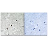 Immunohistochemistry - Anti-RIPK2 Antibody (B8180) - Antibodies.com