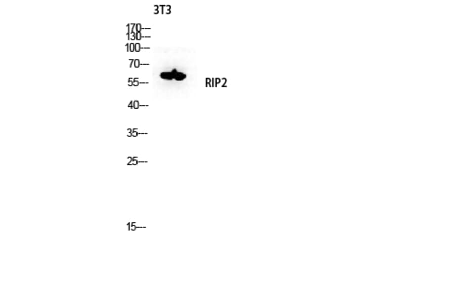 Western Blot - Anti-RIPK2 Antibody (B8180) - Antibodies.com