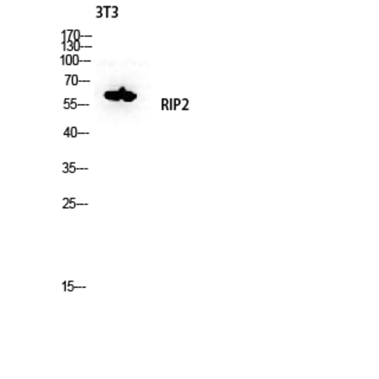Western Blot - Anti-RIPK2 Antibody (B8180) - Antibodies.com