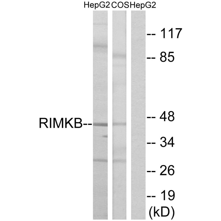 Western Blot - Anti-RIMKB Antibody (C18432) - Antibodies.com