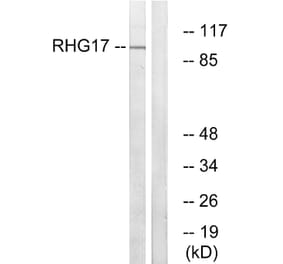 Western Blot - Anti-RHG17 Antibody (C18367) - Antibodies.com