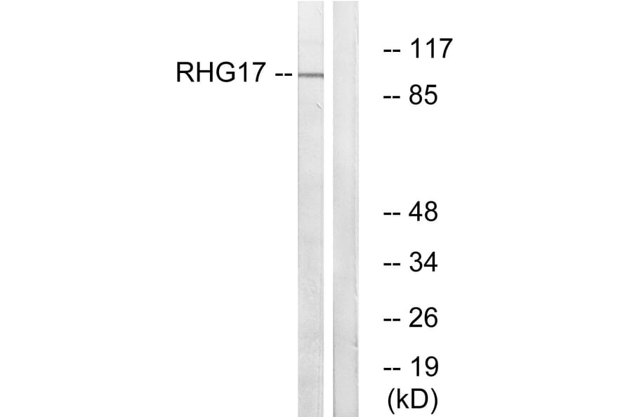 Western Blot - Anti-RHG17 Antibody (C18367) - Antibodies.com